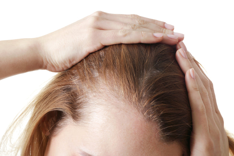Cheveux fins ou clairsemés
